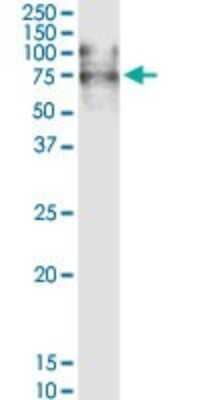 Western Blot: VCAM-1/CD106 Antibody [H00007412-D01P] - Analysis of VCAM1 expression in human spleen.