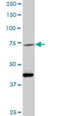 Western Blot: VCAM-1/CD106 Antibody [H00007412-D01P] - Analysis of VCAM1 expression in mouse lung.