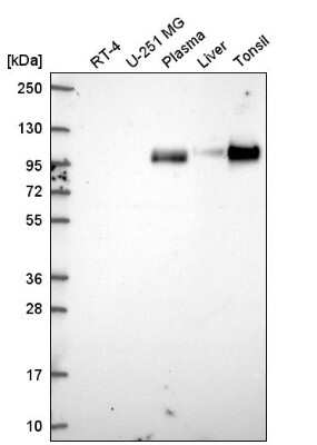 Western Blot: VCAM-1/CD106 Antibody [NBP2-55858] - Analysis in human cell line RT-4, human cell line U-251 MG, human plasma, human liver tissue and human tonsil tissue.