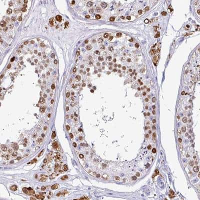 Immunohistochemistry VCY Antibody