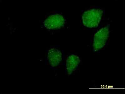 Immunocytochemistry/ Immunofluorescence VCX3A Antibody - Azide and BSA Free