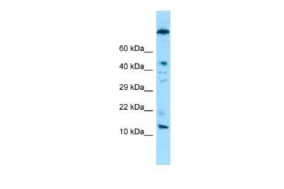 Western Blot: VCY Antibody [NBP2-83748] - WB Suggested Anti-VCY Antibody. Titration: 1.0 ug/ml. Positive Control: Jurkat Whole Cell