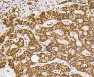 Immunohistochemistry-Paraffin: VDAC1 Antibody (SA93-03) [NBP2-67294] - Analysis of paraffin-embedded human liver tissue using anti-VDAC1 antibody. Counter stained with hematoxylin.