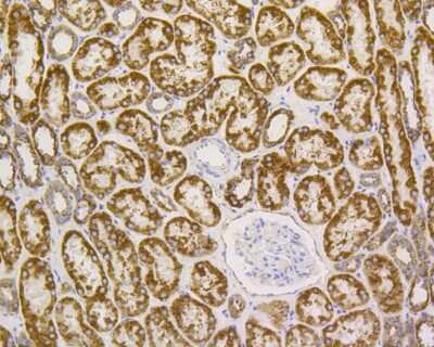 Immunohistochemistry-Paraffin: VDAC1 Antibody (SA93-03) [NBP2-67294] - Immunohistochemical analysis of paraffin-embedded human kidney tissue using anti-VDAC1 antibody. The section was pre-treated using heat mediated antigen retrieval with Tris-EDTA buffer (pH 8.0-8.4) for 20 minutes. The tissues were blocked in 5% BSA for 30