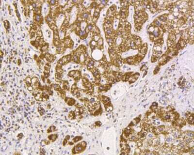 Immunohistochemistry-Paraffin: VDAC1 Antibody (SA93-03) [NBP2-67294] - Immunohistochemical analysis of paraffin-embedded human liver tissue using anti-VDAC1 antibody. The section was pre-treated using heat mediated antigen retrieval with Tris-EDTA buffer (pH 8.0-8.4) for 20 minutes. The tissues were blocked in 5% BSA for 30