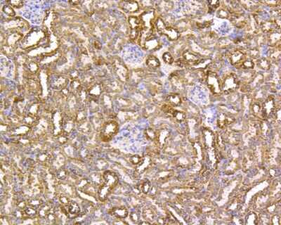 Immunohistochemistry-Paraffin: VDAC1 Antibody (SA93-03) [NBP2-67294] - Immunohistochemical analysis of paraffin-embedded mouse kidney tissue using anti-VDAC1 antibody. The section was pre-treated using heat mediated antigen retrieval with Tris-EDTA buffer (pH 8.0-8.4) for 20 minutes. The tissues were blocked in 5% BSA for 30