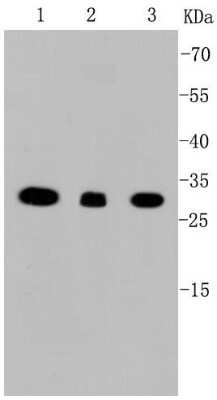 Western Blot: VDAC1 Antibody (SA93-03) [NBP2-67294] - Analysis of VDAC1 on different cell lysates using anti-VDAC1 antibody at 1/1,000 dilution. Positive control: Lane 1: Raji Lane 2: HepG2 Lane 3: SW480