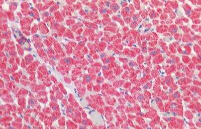 Immunohistochemistry-Paraffin: VDAC2 Antibody [NBP3-12109] - Formalin-Fixed, Paraffin-Embedded HIER human heartusing 10 mM sodium citrate buffer pH 6.0