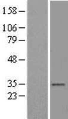 Western Blot VDAC2 Overexpression Lysate