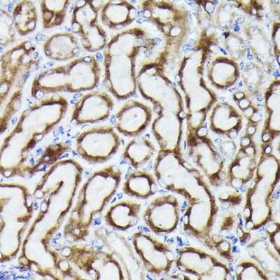 Immunohistochemistry-Paraffin: VDAC3 Antibody [NBP2-94176] - Mouse kidney using VDAC3 Rabbit pAb (NBP2-94176) at dilution of 1:25 (40x lens). Perform high pressure antigen retrieval with 10 mM citrate buffer pH 6.0 before commencing with IHC staining protocol.