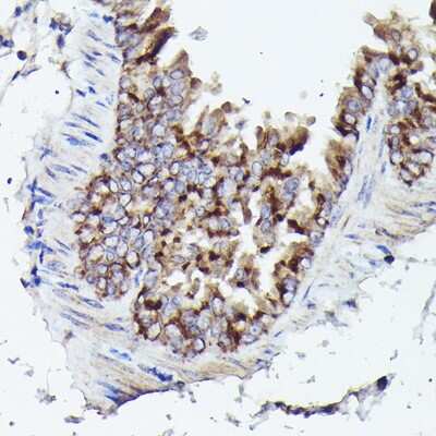 Immunohistochemistry-Paraffin: VDAC3 Antibody [NBP2-94176] - Mouse lung using VDAC3 Rabbit pAb (NBP2-94176) at dilution of 1:25 (40x lens). Perform high pressure antigen retrieval with 10 mM citrate buffer pH 6.0 before commencing with IHC staining protocol.