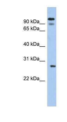 Western Blot: VDAC3 Antibody [NBP1-80069] - Human Thymus lysate, concentration 0.2-1 ug/ml.