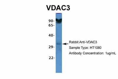 Western Blot: VDAC3 Antibody [NBP1-80069] - HT1080, Antibody Dilution: 1.0 ug/ml.