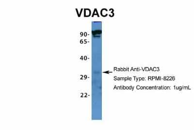 Western Blot: VDAC3 Antibody [NBP1-80069] - RPMI-8226, Antibody Dilution: 1.0 ug/ml.