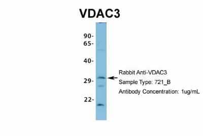 Western Blot: VDAC3 Antibody [NBP1-80070] - Analysis of 721_B cell lysate. Antibody Dilution: 1.0 ug/ml VDAC3 is strongly supported by BioGPS gene expression data to be expressed in Human 721_B cells.