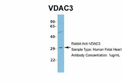 Western Blot: VDAC3 Antibody [NBP1-80070] - Human Fetal Heart, Antibody Dilution: 1.0 ug/ml.