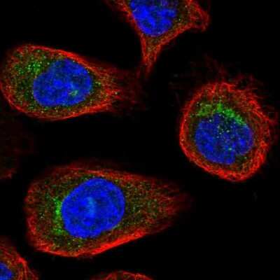 <b>Independent Antibodies Validation. </b>Immunocytochemistry/Immunofluorescence: VDP p115 Antibody [NBP2-55590] - Staining of human cell line A-431 shows localization to the Golgi apparatus.