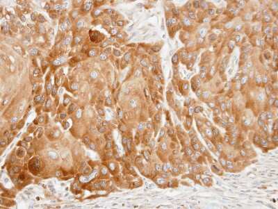 Immunohistochemistry-Paraffin: VDP p115 Antibody [NBP2-20851] - Immunohistochemical analysis of paraffin-embedded SCC15 xenograft, using antibody at 1:100 dilution.