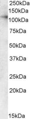 Western Blot: VDP p115 Antibody [NB100-2430] - Staining of Human Kidney and Liver lysates (35ug protein in RIPA buffer). Detected by chemiluminescence.