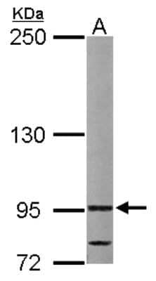 Western Blot: VDP p115 Antibody [NBP2-17245] - Sample (50 ug of whole cell lysate) A: Mouse Liver, 5% SDS PAGE gel, diluted at 1:1000.