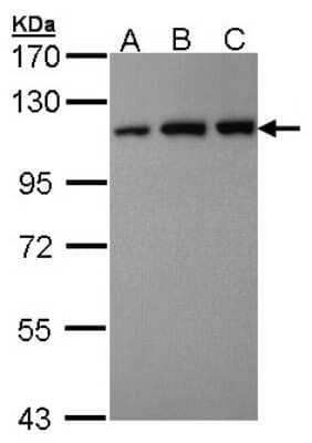 Western Blot: VDP p115 Antibody [NBP2-20851] - Sample (30 ug of whole cell lysate) A: Hela B: Hep G2 C: Molt-4 7. 5% SDS PAGE gel, diluted at 1:10000.