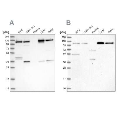 Western Blot: VDP p115 Antibody [NBP2-38401] - Analysis using Anti-USO1 antibody NBP2-38401 (A) shows similar pattern to independent antibody NBP2-55590 (B).