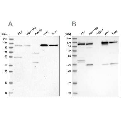 Western Blot: VDP p115 Antibody [NBP2-55590] - Analysis using Anti-USO1 antibody NBP2-55590 (A) shows similar pattern to independent antibody NBP2-38401 (B).