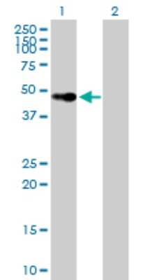 Western Blot: VDR/NR1I1/Vitamin D Receptor Antibody [H00007421-B01P] - Analysis of VDR expression in transfected 293T cell line by VDR polyclonal antibody.  Lane 1: VDR transfected lysate(46.97 KDa). Lane 2: Non-transfected lysate.
