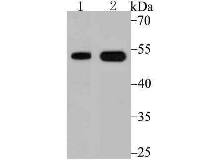 Western Blot: VDR/NR1I1/Vitamin D Receptor Antibody [NBP3-09078] - Western blot analysis of Vitamin D Receptor on PC-3M cell and human small intestine tissue lysate using anti-Vitamin D Receptor antibody at 1/500 dilution.