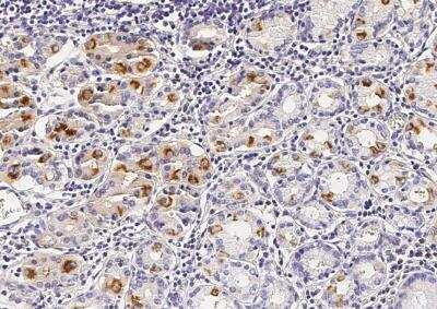 Immunohistochemistry-Paraffin: VE-Cadherin Antibody (012) [NBP2-89497] - Staining of human Cad5 in human stomach with rabbit monoclonal antibody (1:500).