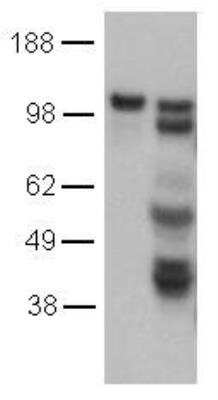 Western Blot: VE-Cadherin Antibody (16B1) [NBP2-00342] - EDTA-passaged (left) and Trypsin-passaged (right) Human Umbilical Vein Endothelial Cells (HUVEC) were resolved by SDS -PAGE and immunoblotted with 2 ug/mL of Anti-Human CD144 (VE-Cadherin) Purified and revealed with Anti-Rat IgG HRP.