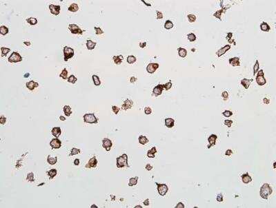 Immunocytochemistry: VE-Cadherin Antibody (BLR091G) [NBP2-80140] - Detection of human VE-Cadherin in FFPE HUVEC cells by ICC. Antibody: Rabbit anti-VE-Cadherin recombinant monoclonal [BLR091G] (NBP2-80140). Secondary: HRP-conjugated goat anti-rabbit IgG. Substrate: DAB.