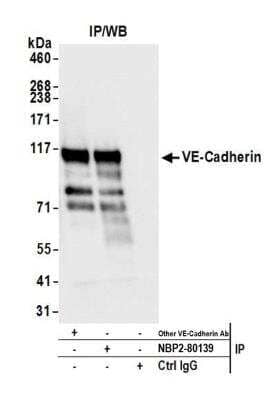 Immunoprecipitation: VE-Cadherin Antibody (BLR091G) [NBP2-80140] - Detection of human VE-Cadherin by WB of immunoprecipitates from BeWo lysate. Antibodies: Rabbit anti-VE-Cadherin recombinant monoclonal [BLR091G] (NBP2-80140) and another rabbit anti-VE-Cadherin recombinant monoclonal.