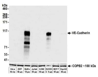 Western Blot: VE-Cadherin Antibody (BLR091G) [NBP2-80140] - Detection of human VE-Cadherin by WB of HeLa, HEK293T, BeWo, Jurkat, K-562, HUVEC-C, MCF-7, and Hep-G2 lysate. Antibody: Rabbit anti-VE-Cadherin recombinant monoclonal [BLR091G] (NBP2-80140). Secondary: HRP-conjugated goat anti-rabbit IgG. Lower Panel: Rabbit anti-COPB2 (A305-523A).