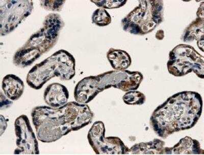 Immunohistochemistry-Paraffin: VE-Cadherin Antibody (MM0012-8A03) [NB110-60978] - Formalin fixed and paraffin embedded human placental tissue section is subjected to IHC with anti human VE-Cadherin