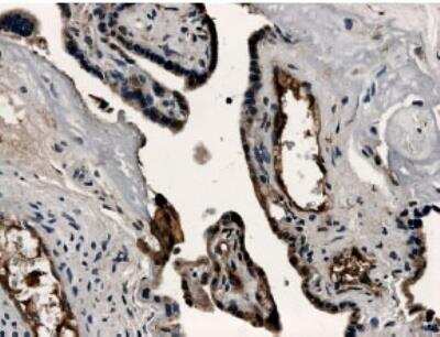 Immunohistochemistry-Paraffin: VE-Cadherin Antibody (MM0012-8A03) [NB110-60978] - Formalin fixed and paraffin embedded human placental tissue section is subjected to IHC with anti human VE-Cadherin