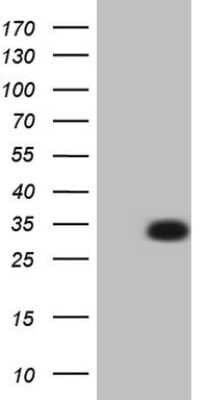 Western Blot: VE-Statin/EGFL7 Antibody (2B5) [NBP2-46485] - Analysis of HEK293T cells were transfected with the pCMV6-ENTRY control (Left lane) or pCMV6-ENTRY EGFL7.