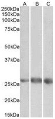 Western Blot: VE-Statin/EGFL7 Antibody [NBP2-44320] - Analysis of Heart (A), Kidney (B) and Lung (C) lysates (35ug protein in RIPA buffer).