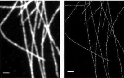 Immunofluorescence: VECTASHIELD(R) Antifade Mounting Medium [H-1000-NB] - STORM imaging of Alexa Fluor 647 stained microtubules in VECTASHIELD Mounting Medium. (Image kindly supplied by Dr. Nicolas Olivier, King's College, London UK.)