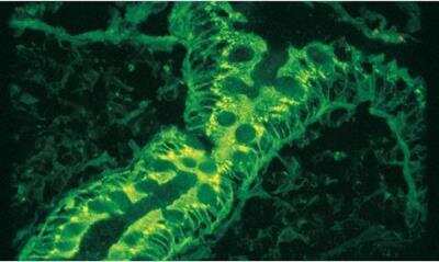 Immunohistochemistry: VECTASHIELD(R) Antifade Mounting Medium [H-1000-NB] - Colon stained with fluorescein labeled Amaranthus caudatus lectin mounted with VECTASHIELD Mounting Medium.