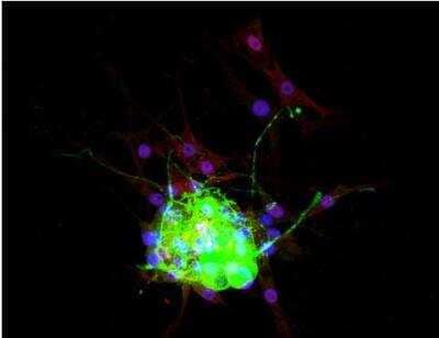 Cellular Imaging: VECTASHIELD(R) Hard Set(TM) Antifade Mounting Medium with DAPI [H-1500-NB] - Dorsal root ganglia cells (neurons and satellite glia) - double label. BIII tubulin, DyLight 488 labeled secondary antibody (green). S100, DyLight 594 labeled secondary antibody (red). Mounted in VECTASHIELD HardSet Mounting Medium with DAPI