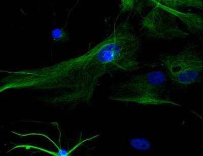 Immunocytochemistry/Immunofluorescence: VECTASHIELD(R) Hard Set(TM) Antifade Mounting Medium with DAPI [H-1500-NB] -  Astrocytes: Stained for GFAP and detected with Dylight 488 labeled secondary antibody. Mounted in VECTASHIELD HardSet Mounting Medium with DAPI. Image courtesy of Dr Emma East, Department of Life Sciences, The Open University, U.K.*