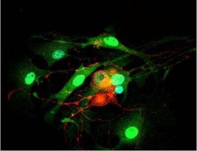 Immunocytochemistry/Immunofluorescence: VECTASHIELD(R) Hard Set(TM) Antifade Mounting Medium with DAPI [H-1500-NB] - Dorsal root ganglia cells (neurons and satellite glia) - double label. BIII tubulin, DyLight 594 labeled secondary antibody (red). S100, DyLight 488 labeled secondary antibody (green). Mounted in VECTASHIELD HardSet Mounting Medium with DAPI.