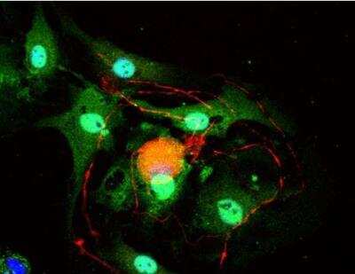 Immunocytochemistry/Immunofluorescence: VECTASHIELD(R) Hard Set(TM) Antifade Mounting Medium with DAPI [H-1500-NB] - Dorsal root ganglia cells (neurons and satellite glia) - double label. BIII tubulin, DyLight 594 labeled secondary antibody (red). S100, DyLight 488 labeled secondary antibody (green). Mounted in VECTASHIELD HardSet Mounting Medium with DAPI.