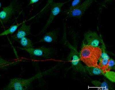 Immunocytochemistry/Immunofluorescence: VECTASHIELD(R) Hard Set(TM) Antifade Mounting Medium with DAPI [H-1500-NB] - Dorsal root ganglia cells (neurons and satellite glia) - double label. BIII tubulin, DyLight 549 labeled secondary antibody (red). S100, DyLight 488 labeled secondary antibody (green). Mounted in VECTASHIELD HardSet Mounting Medium with DAPI.