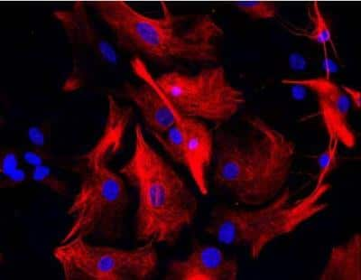 Immunocytochemistry/Immunofluorescence: VECTASHIELD(R) Hard Set(TM) Antifade Mounting Medium with DAPI [H-1500-NB] - Astrocytes: Stained for GFAP and detected with Dylight 594 labeled secondary antibody. Mounted in VECTASHIELD HardSet Mounting Medium with DAPI. Image courtesy of Dr Emma East, Department of Life Sciences, The Open University, U.K.*