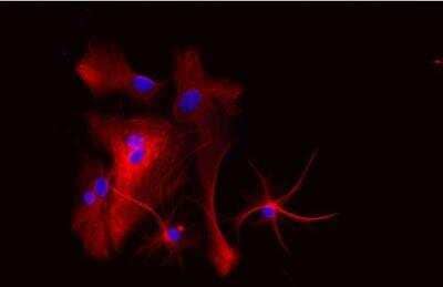 Immunocytochemistry/Immunofluorescence: VECTASHIELD(R) Hard Set(TM) Antifade Mounting Medium with DAPI [H-1500-NB] - Astrocytes: Stained for GFAP and detected with Dylight 594 labeled secondary antibody. Mounted in VECTASHIELD HardSet Mounting Medium with DAPI. Image courtesy of Dr Emma East, Department of Life Sciences, The Open University, U.K.*