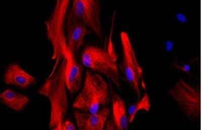 Immunocytochemistry/Immunofluorescence: VECTASHIELD(R) Hard Set(TM) Antifade Mounting Medium with DAPI [H-1500-NB] - Astrocytes: Stained for GFAP and detected with Dylight 549 labeled secondary antibody. Mounted in VECTASHIELD HardSet Mounting Medium with DAPI. Image courtesy of Dr Emma East, Department of Life Sciences, The Open University, U.K.*