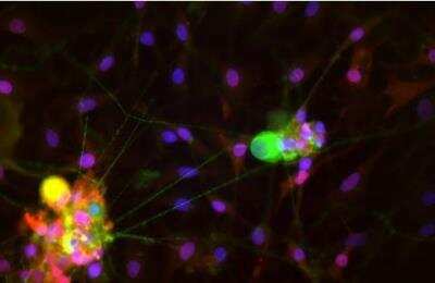 Immunocytochemistry/Immunofluorescence: VECTASHIELD(R) Hard Set(TM) Antifade Mounting Medium with DAPI [H-1500-NB] - Dorsal root ganglia cells (neurons and satellite glia) - double label. BIII tubulin, DyLight 488 labeled secondary antibody (green). S100, DyLight 594 labeled secondary antibody (red). Mounted in VECTASHIELD HardSet Mounting Medium with DAPI.