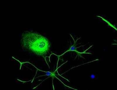 Immunocytochemistry/Immunofluorescence: VECTASHIELD(R) Hard Set(TM) Antifade Mounting Medium with DAPI [H-1500-NB] - Astrocytes: Stained for GFAP and detected with Dylight 488 labeled secondary antibody. Mounted in VECTASHIELD HardSet Mounting Medium with DAPI. Image courtesy of Dr Emma East, Department of Life Sciences, The Open University, U.K.*